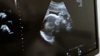 сократилось количество абортов среди подростков, фото - Новости Zakon.kz от 22.11.2022 17:24