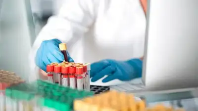 coronavirus, фото - Новости Zakon.kz от 15.06.2020 08:00