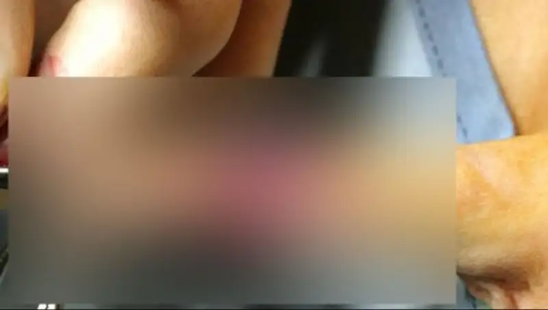 Хакеры украли фото звезд с операций по увеличению гениталий