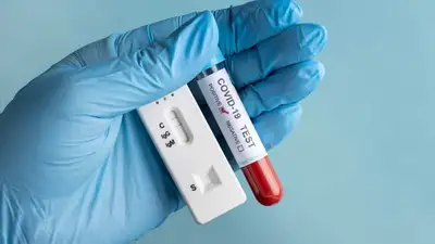 46 человек заразились коронавирусом за сутки в Казахстане, фото - Новости Zakon.kz от 12.02.2023 09:29