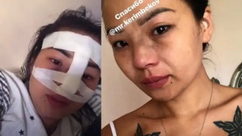 Эпатажную алматинскую стриптизершу и бизнес-леди избил возлюбленный