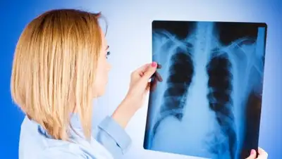 medweb.ru, фото - Новости Zakon.kz от 08.02.2018 14:17