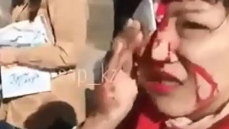 В Караганде женщина разбила лицо, пытаясь сесть в автобус