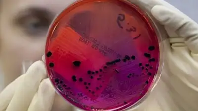 Медики рассказали, как уберечься от сибирской язвы, фото - Новости Zakon.kz от 10.06.2023 07:55