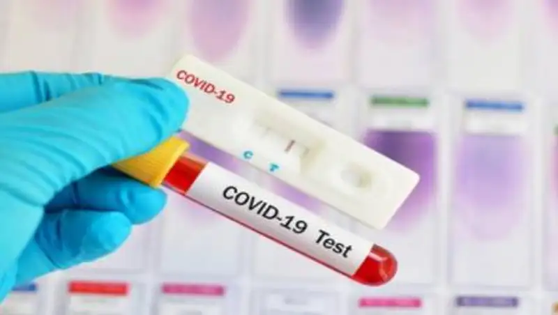 За прошедшие сутки в Алматы не зарегистрировано ни одного случая COVID-19