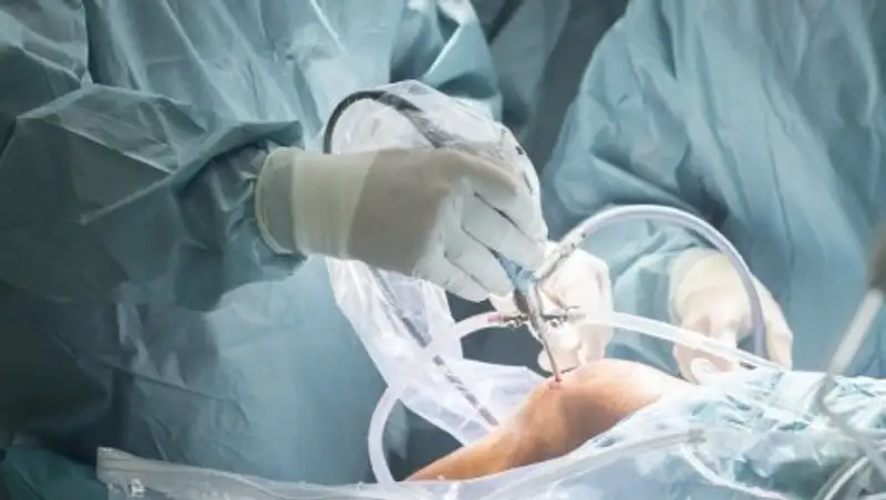 Казахстанские микрохирурги провели уникальную пластическую операцию