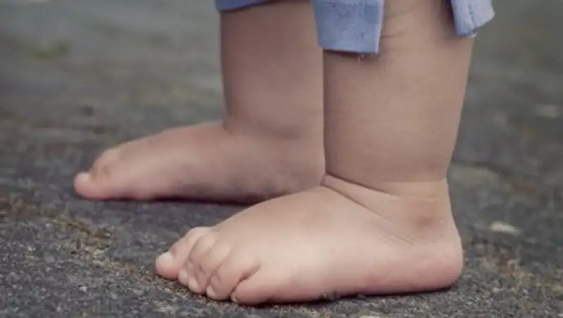 В Биробиджане 5-летний мальчик впал в кому после избиения другими детьми