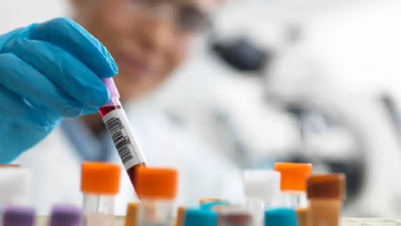 Проводилась ли регистрация и медэкспертиза экспресс-тестов на КВИ