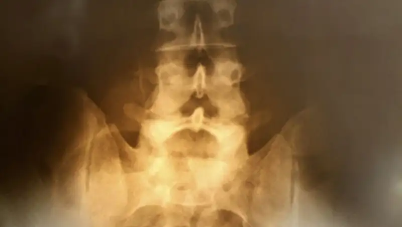 Ученые научились исцелять паралич