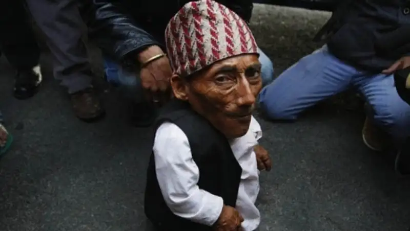 Умер самый маленький человек в мире