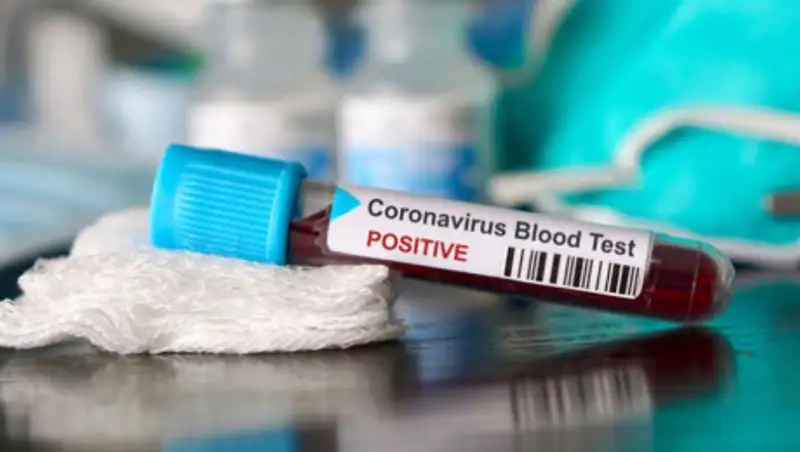 Врачи рассказали о состоянии 29 заболевших коронавирусом в Атырау