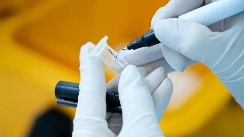 Более тысячи случаев заражения COVID-19 выявили в Казахстане за сутки