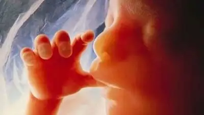 Zakon.kz, фото - Новости Zakon.kz от 21.08.2017 11:20