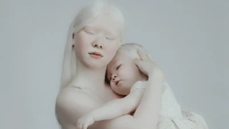 Словно из сказки. Завораживающая внешность сестер-альбиносов из Актау