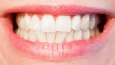 pxhere.com, фото - Новости Zakon.kz от 11.06.2021 09:17