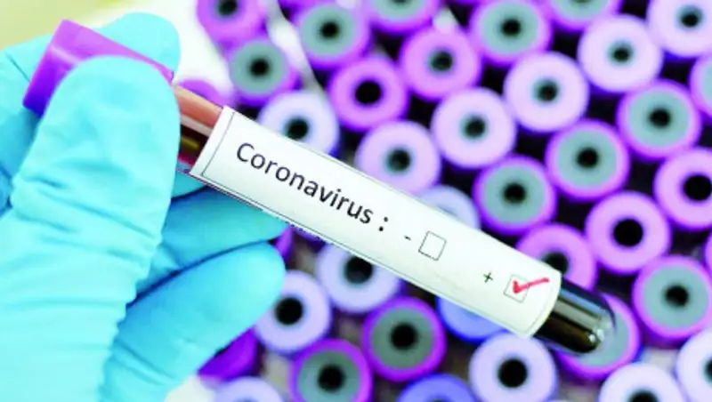 Экспресс-тесты на коронавирус могут появиться в Нур-Султане