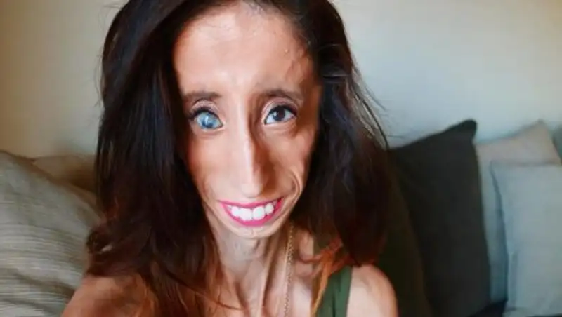 Против оскорбительных мемов выступила "самая некрасивая женщина мира"