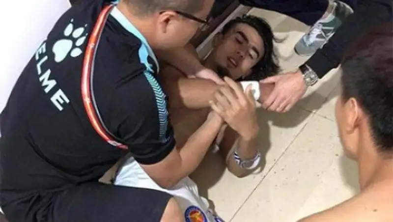 Охранники дубинками избили игроков китайской команды в раздевалке