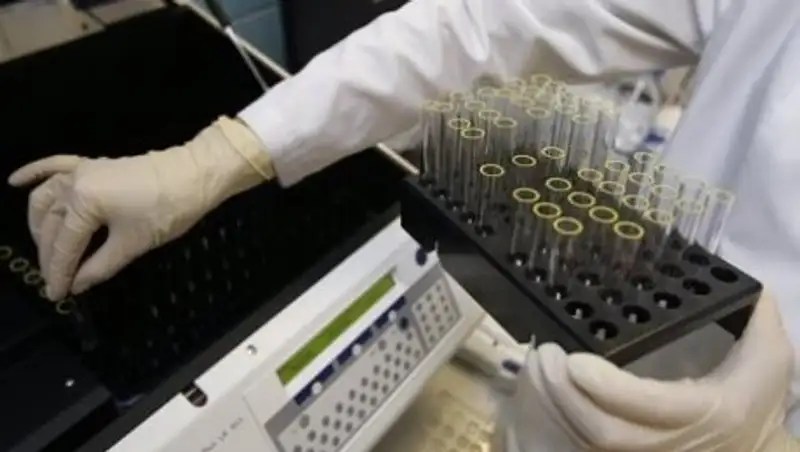 Все допинг-пробы, взятые на Универсиаде-2017 в Алматы, оказались отрицательными