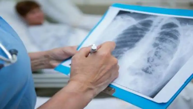 Семь человек скончались от коронавируса и пневмонии в Казахстане