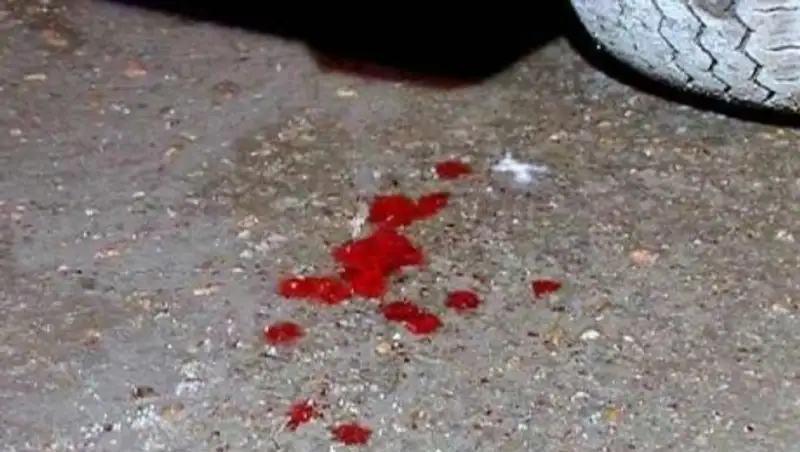 В Костанае ищут очевидцев наезда на женщину, которая скончалась в реанимации