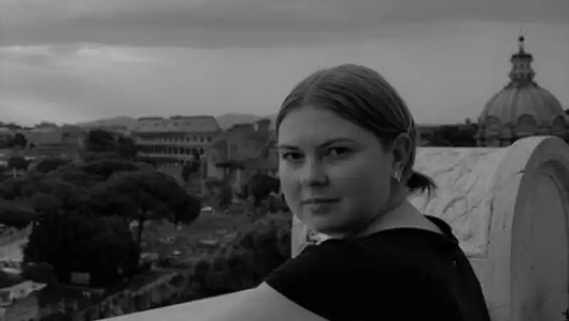 Умерла облитая кислотой украинская чиновница