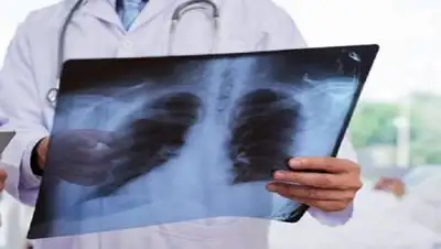 khabar.kz, фото - Новости Zakon.kz от 25.11.2020 09:09