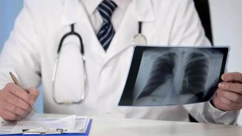 За сутки не зафиксировано смертей от пневмонии в Казахстане