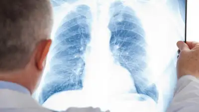 Газета.ру, фото - Новости Zakon.kz от 11.08.2020 09:12