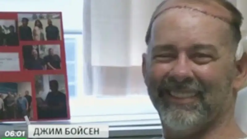 Техасские врачи первыми в мире пересадили пациенту часть черепа
