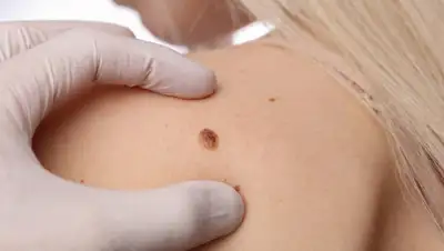 b-apteka.ru, фото - Новости Zakon.kz от 22.07.2020 12:05