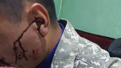 Лесника Иле-Алатауского нацпарка жестоко избили, фото - Новости Zakon.kz от 03.10.2023 17:54