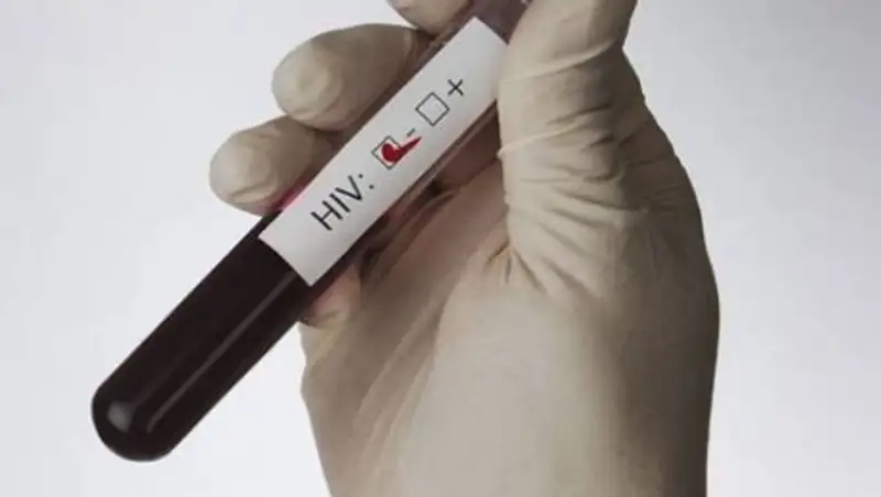 Около 5 тысяч случаев заболевания ВИЧ зарегистрировано в Алматы