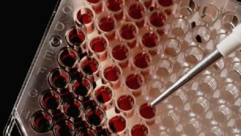 Казахстанских туристов предупредили о вспышке гепатита А в Европе