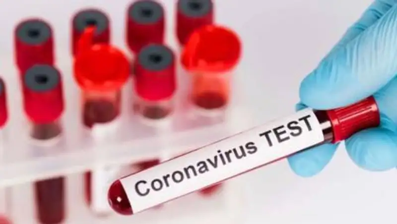 22 прилетевших из-за границы казахстанца со скандалом отправились на карантин