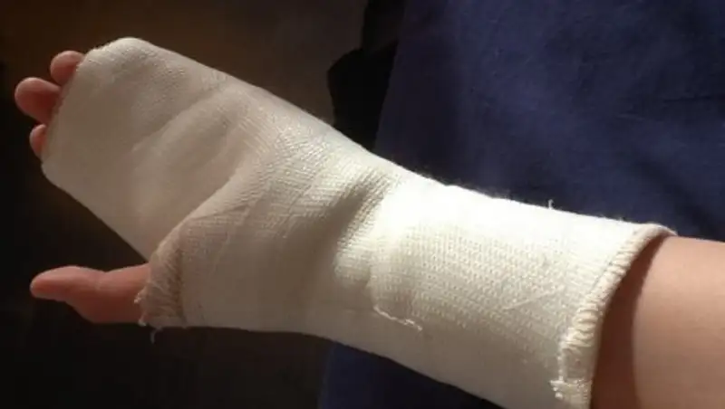 Подробности ЧП с эскалатором и девочкой в Астане