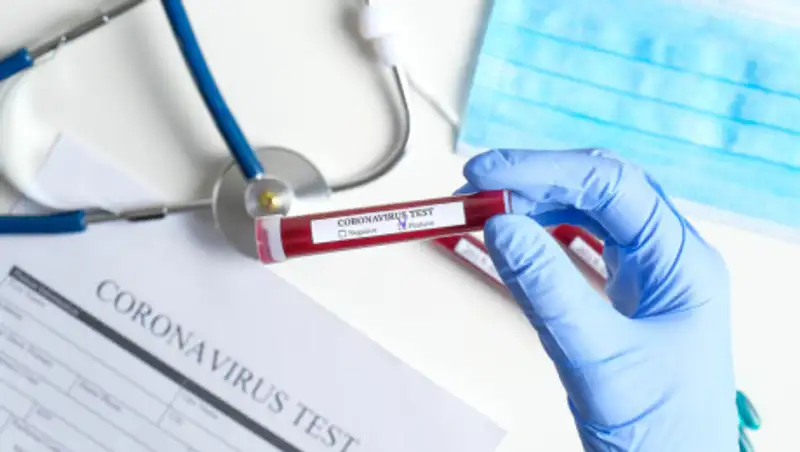 Четверо казахстанцев умерли от коронавируса