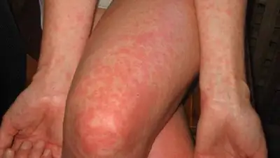 pronedra.ru, фото - Новости Zakon.kz от 10.03.2020 11:49