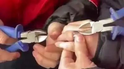Спасатели ВКО помогли мальчику, чей палец застрял в железном кольце, фото - Новости Zakon.kz от 15.01.2023 01:02