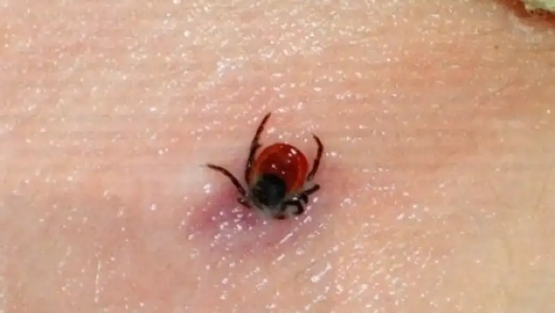 В Жамбылской области от конго-крымской геморрагической лихорадкой погибли 2 человека