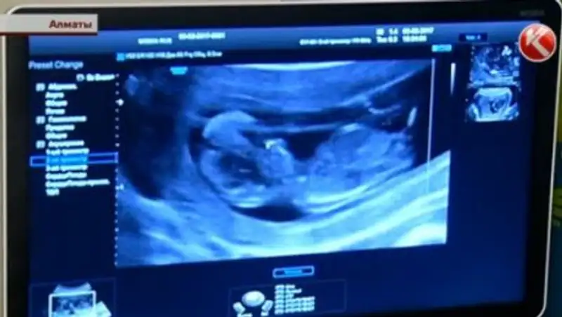 Казахстанцы жалуются на плохую работу специалистов УЗИ