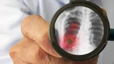 Shutterstoc, фото - Новости Zakon.kz от 19.11.2020 09:03