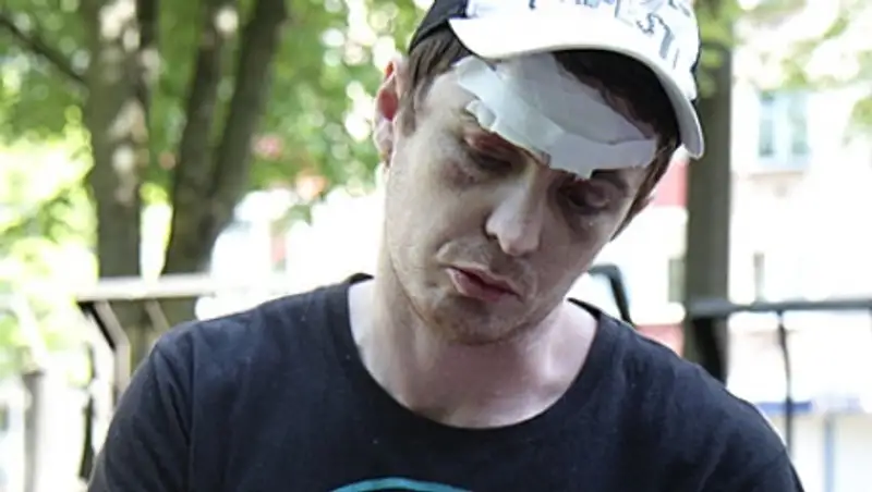 Белорус отсудил 30 миллионов за разбитую шайбой голову