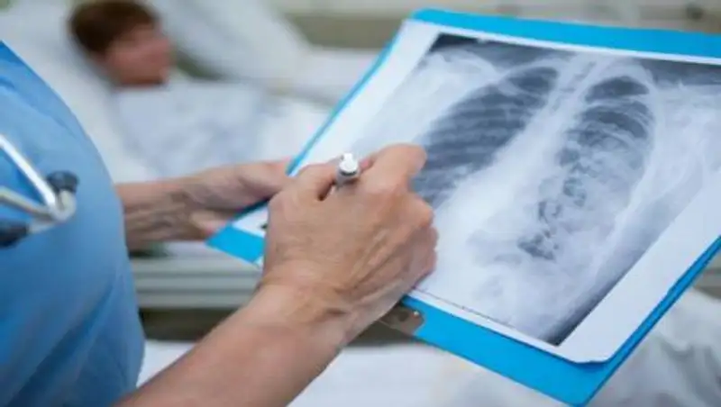 В Казахстане зафиксирован скачок смертей от коронавируса и пневмонии