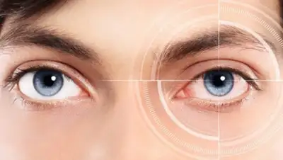 medweb.ru, фото - Новости Zakon.kz от 18.05.2019 14:00