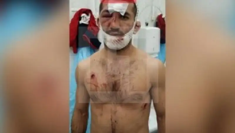 Нападение на Расула Мирзаева организовала обиженная им девушка