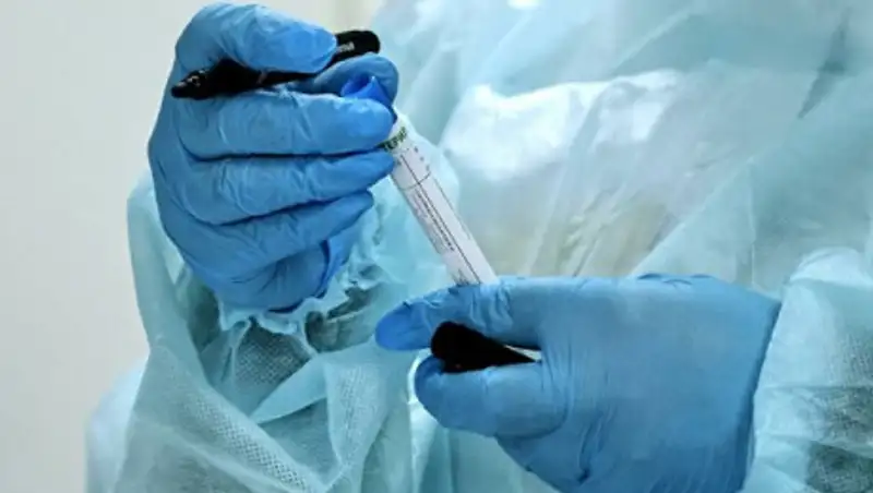 Названа группа людей с высоким риском летального исхода при COVID-19