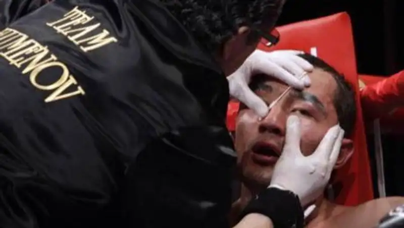 Я никого не боюсь и готовился нокаутировать Дортикоса, но доктор запретил драться - Шуменов