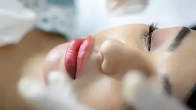 Казахстан Минздрав косметология блефаропластика, фото - Новости Zakon.kz от 05.10.2023 18:05