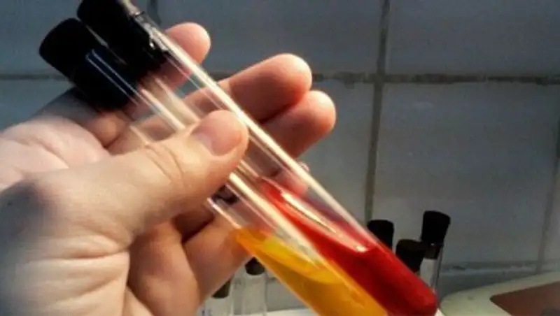 У сотрудников детского лагеря в Костанае обнаружили кишечную палочку